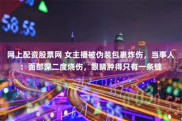 网上配资股票网 女主播被伪装包裹炸伤，当事人：面部深二度烧伤，眼睛肿得只有一条缝